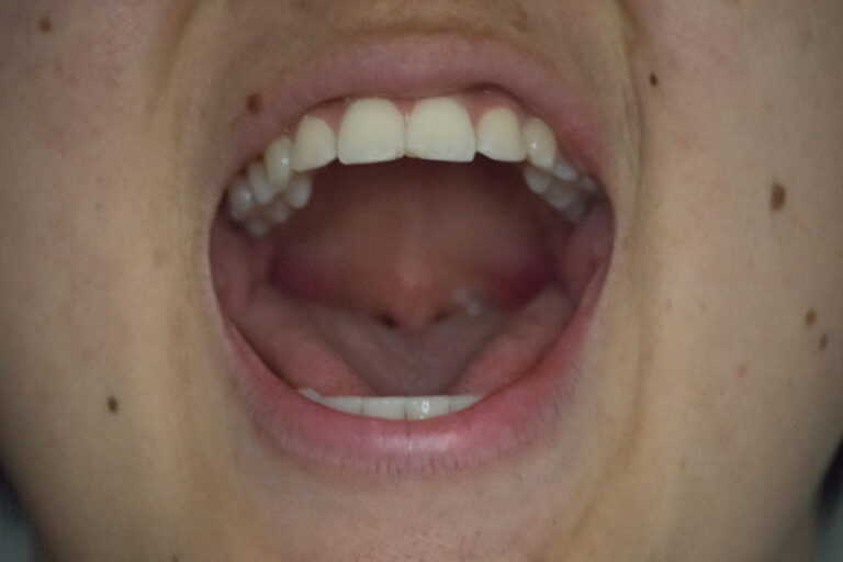 Humor: Student shouts out answer a split second before everyone else to show his brilliance