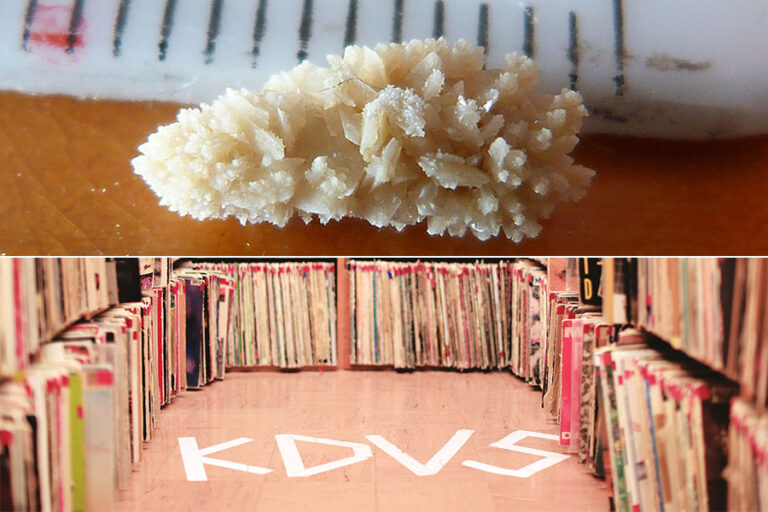 Humor: Edgy KDVS to play full hour of Ralph J. Hexter passing kidney stone