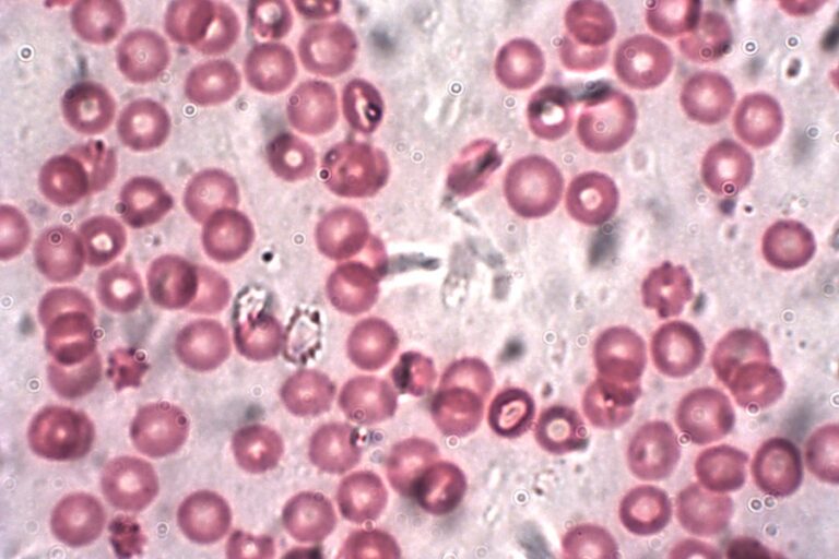 How technology can make healthcare more affordable