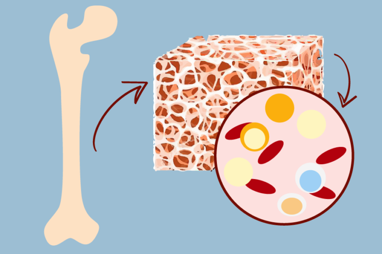 UC Davis Immunology researchers engineer a bone marrow to research early osteosarcoma