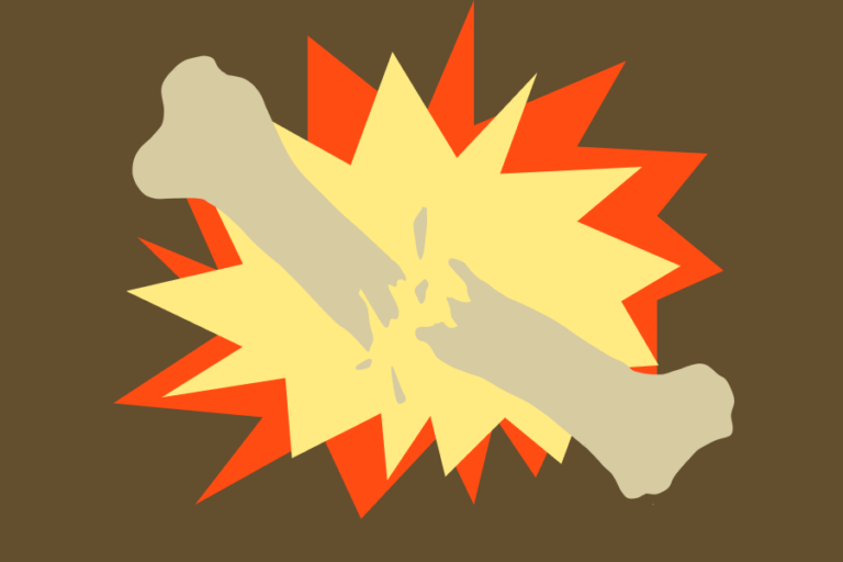 UC Davis Health develops Fragility Fracture Program to identify and provide care for patients at risk of osteoporosis