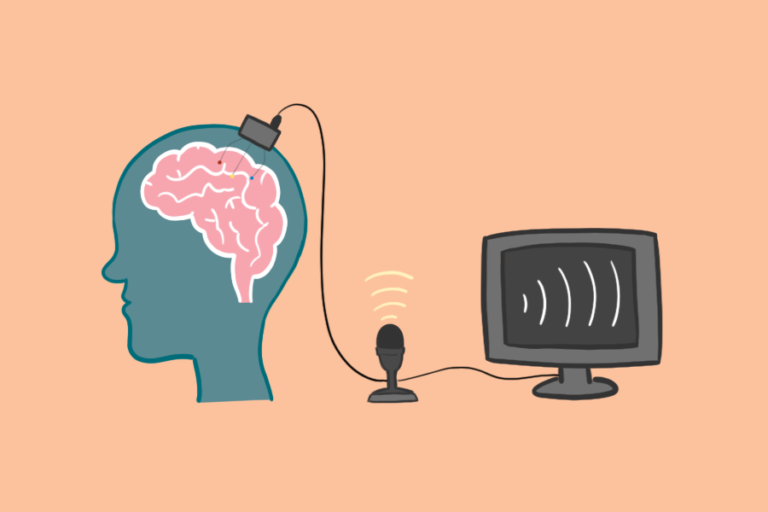 UC Davis Health pilot clinical study aims to restore speech in patients with paralysis 