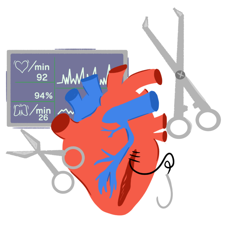 Revolutionary heart device debuts at UC Davis Health, offering hope to high-risk patients