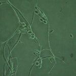 Brettanomyces bruxellensis