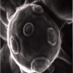 Saccharomyces cerevisiae